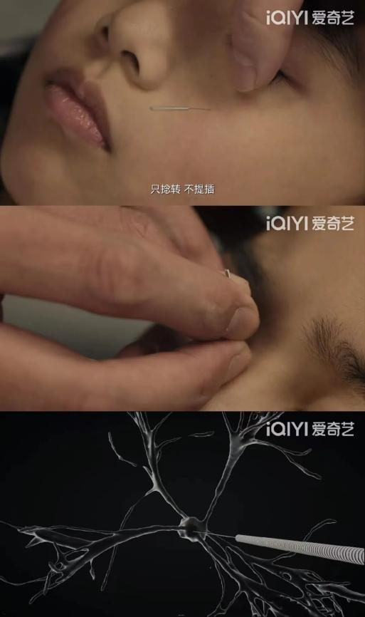 《谢谢你医生》《促醒者》等同台打擂,医疗剧走向“社会化”?